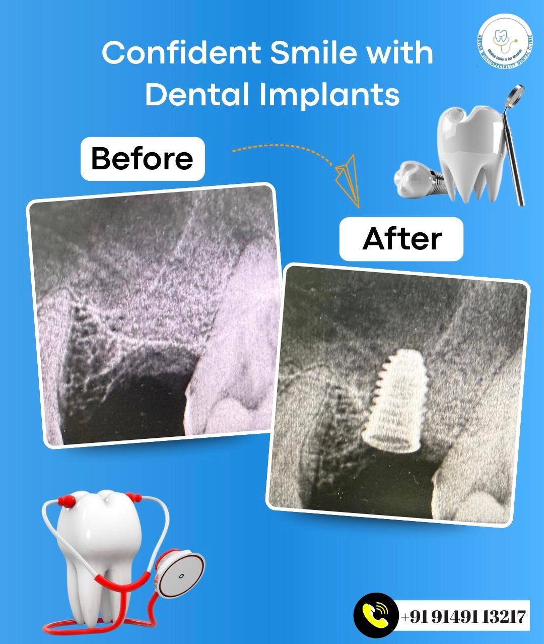 Before and after transformation