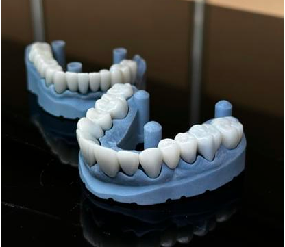 Dental Bridges