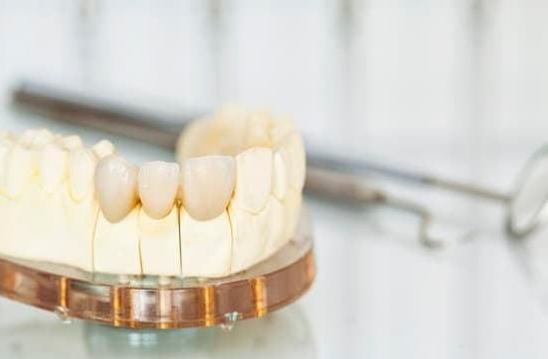 Dental Crowns