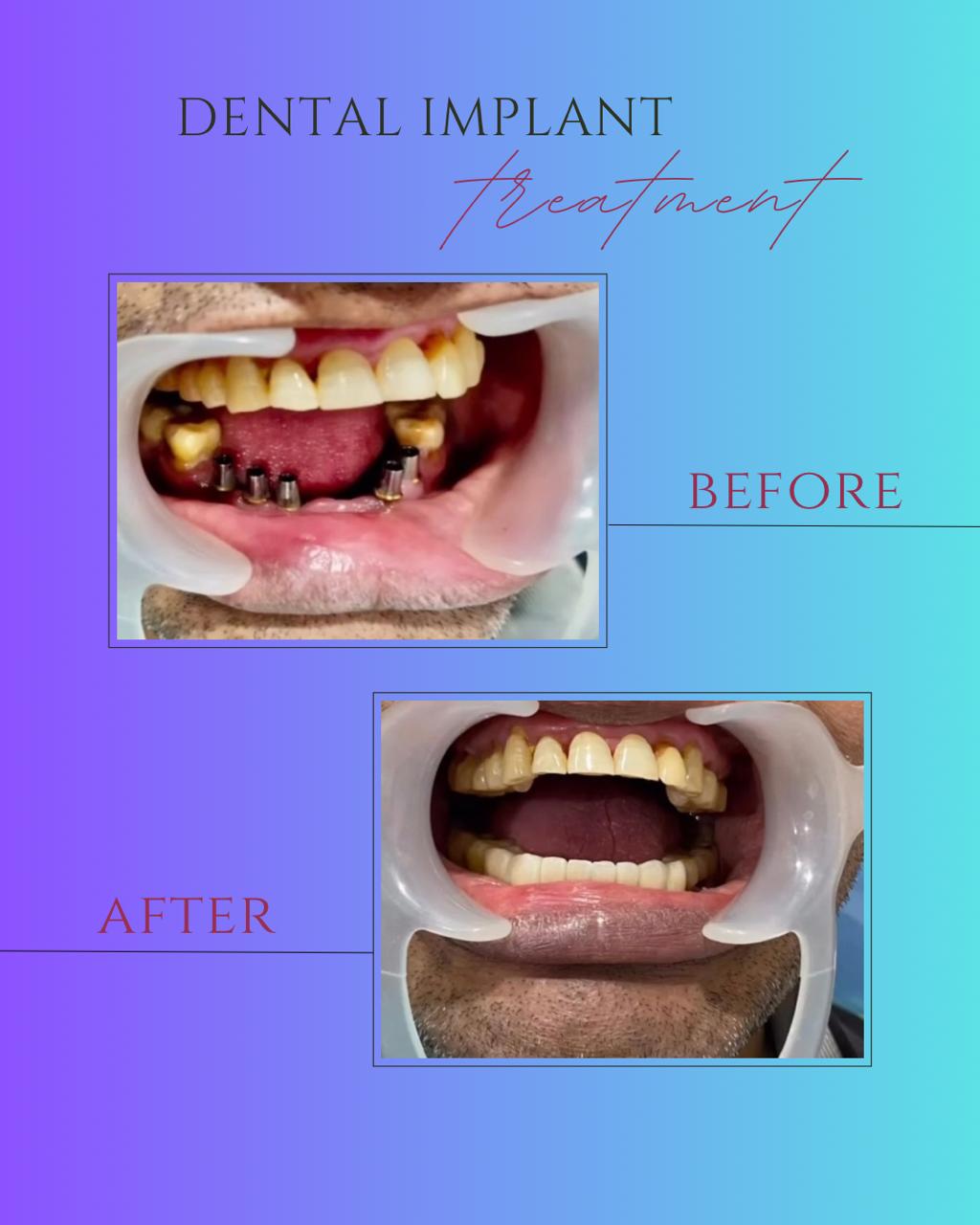 Before and after transformation
